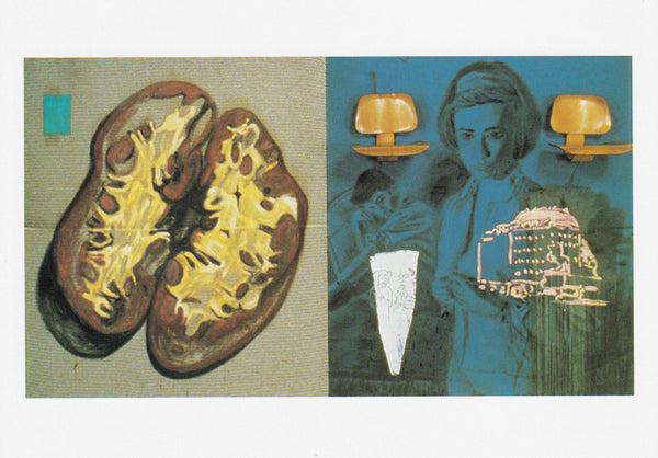 David Salle: Postcard (Brother Animal) – MOCA Store